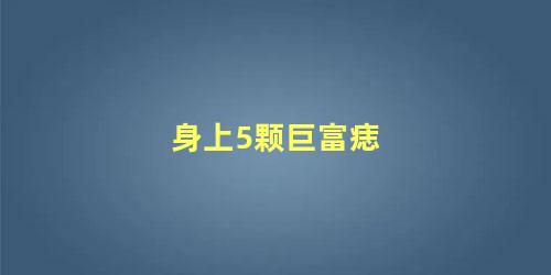 身上5颗巨富痣