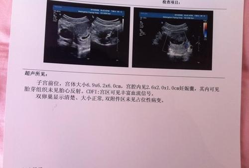 怎么查命里有几个孩子