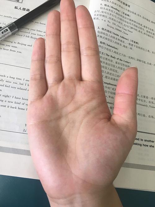 看手相能看出人得什么病吗