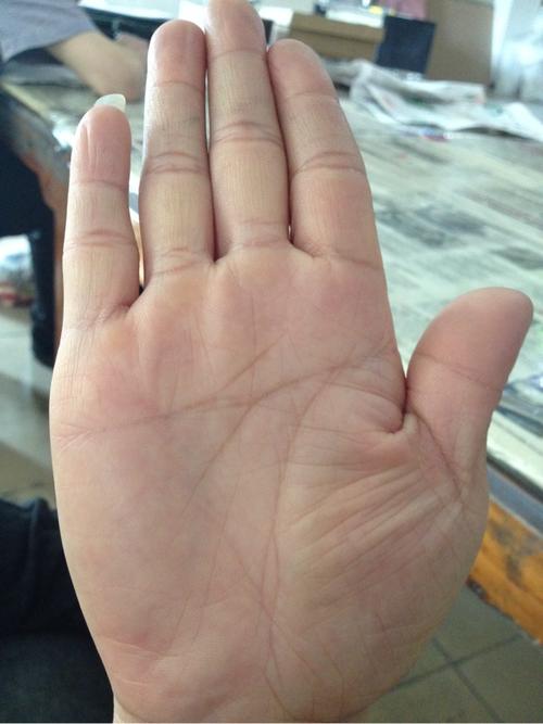 看手相能看出人得什么病吗