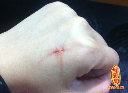 梦见有人头部受伤出血