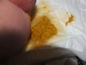 梦见拉大便旁边有人