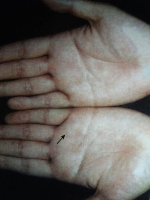 什么风水引来肿瘤