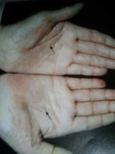 什么风水引来肿瘤