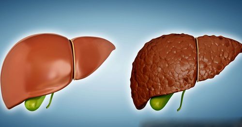 什么风水对肝不好